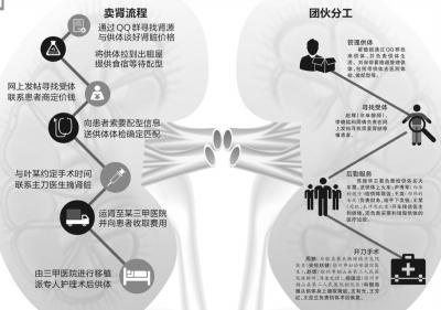 全國最大販腎案終審-組織者摘腎51枚獲利千萬2