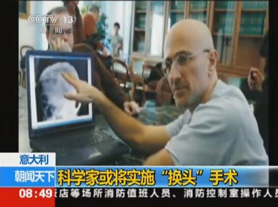 首例人類“換頭”手術將實施：比死還難受