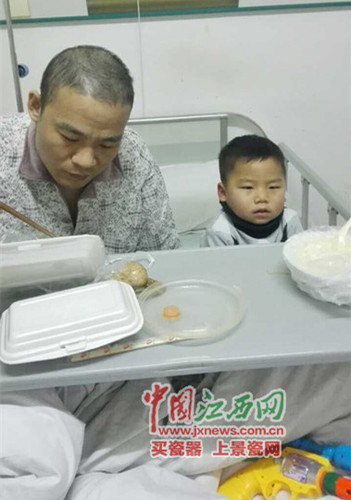 在化療期間，沈志勇的頭發幾乎全部掉光