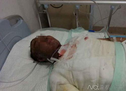 傷者正在醫院接受治療