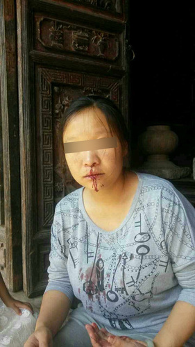 被打的產婦陸某。