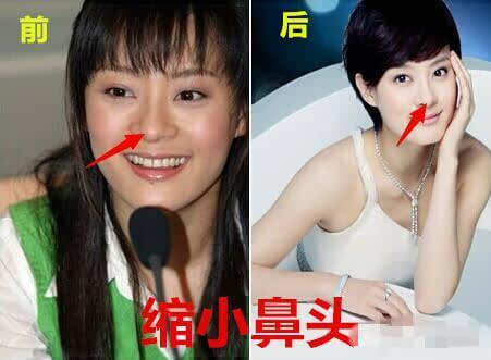 孫儷被導(dǎo)演贊用生命演戲，這次孫儷自曝整過(guò)容，這算不算也是用生命在演戲？1