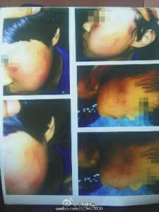 女老師連扇小學(xué)生10多個耳光 遭家長毆打(圖)