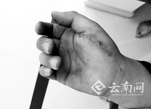 小區(qū)電梯突墜8歲娃被嚇慘 被困近20分鐘后獲救