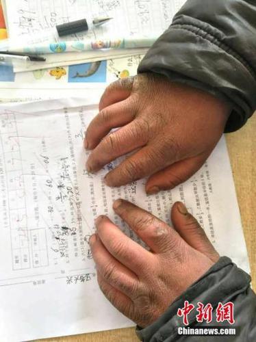 點擊進入下一頁