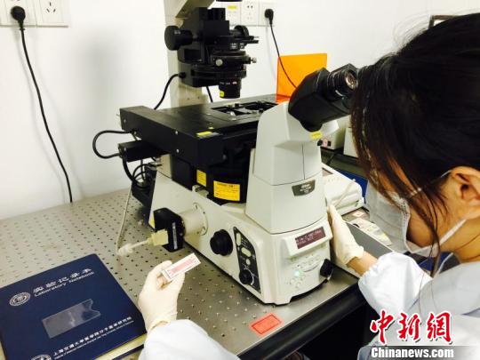 2毫升孕婦外周血即可查遺傳異常專家研發無創技術