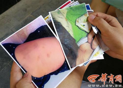 幼兒園內(nèi)男童遭老師“背摔” 園方:已解聘當事老師