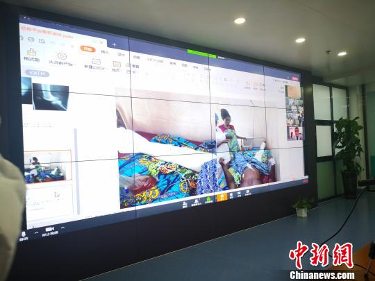 援貝醫療隊骨科醫師馬國強在講述患者病歷?！『珮s 攝
